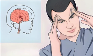 突然发呆、闻到怪味？这可能是癫痫的“伪装”，90%的人都忽略了